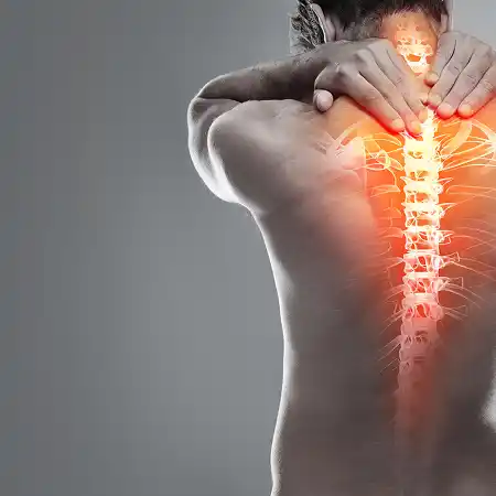 Herniated cervical discs